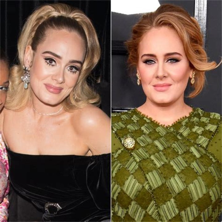 Adele’s New Slim Nose May Be the Result of ‘Some Surgical Help,’ According to an Expert