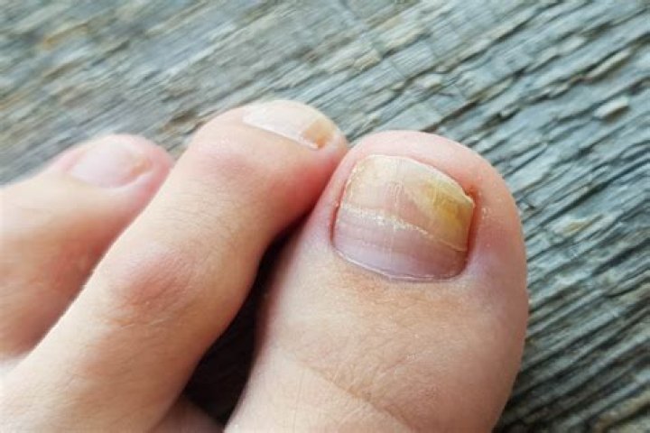Kim Kardashian Is Being Body-Shamed for Her “Yellow” Toenail — and the Comments Are Bizarre